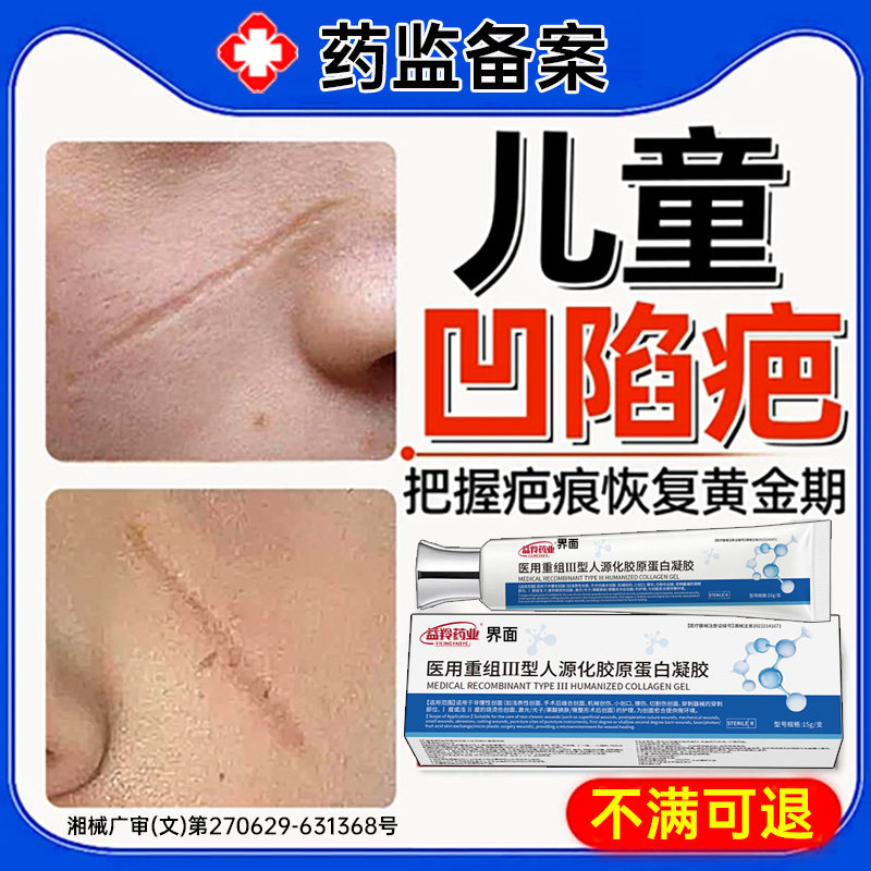 儿童凹陷性疤痕生长因子祛疤膏填充膏修复除疤膏指甲抓伤摔伤UU