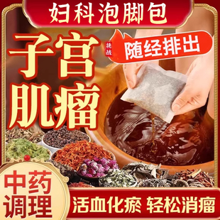 子宫肌瘤泡脚包中药贴消除艾灸卵巢囊肿贴自己治热敷调理多发性UU