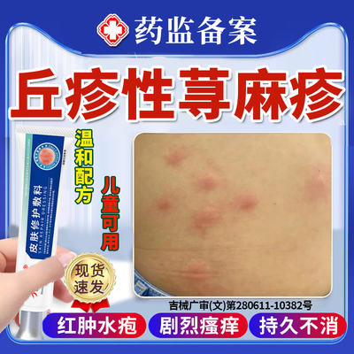 寻荨麻疹过敏止痒根虫咬丘疹性皮炎瘙痒皮肤湿疹膏抗菌消炎专用YB