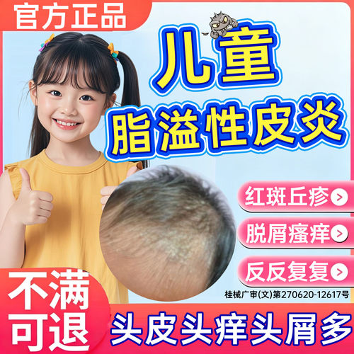 儿童脂溢性皮炎毛囊炎洗发水去屑止痒抑菌头有疙瘩痤疮真菌感染PP