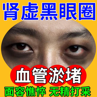 肾虚黑眼圈去除神器特别严重黑色素沉淀药房款膏强力血管型眼贴WY