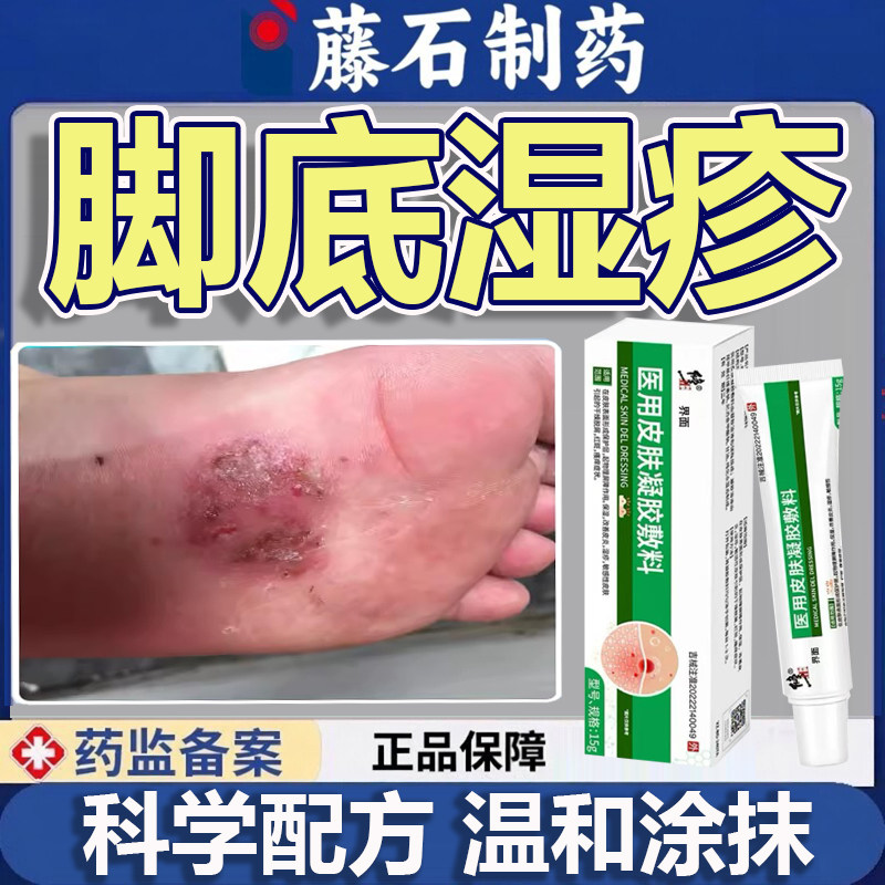 脚气止痒脱皮杀菌真菌感染专用脚底湿疹去脚上慢性根皮肤的克星MR