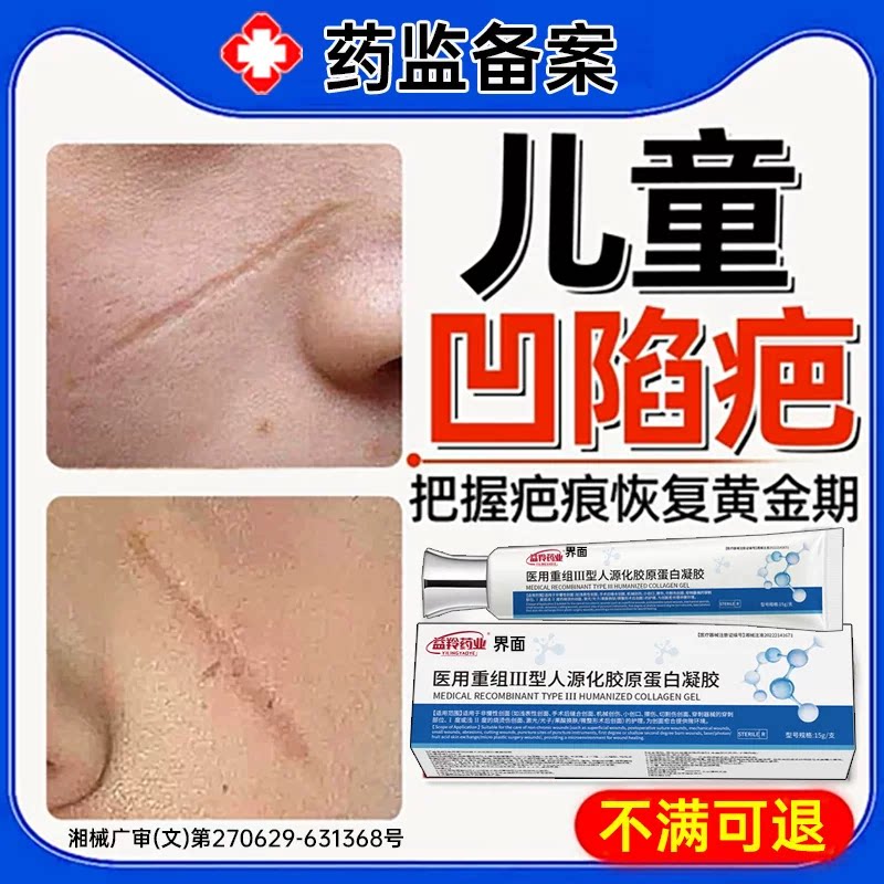 儿童凹陷性疤痕重组生长因子祛疤膏填充膏修复除疤指甲抓伤摔伤UU
