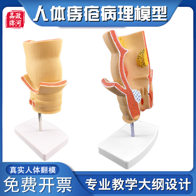 直肠模型痔疮演示模型人体模x型器官解剖内脏模型医院学校教学模