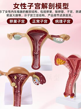 人体模型女性生殖子宫模型生殖卵巢模型教学模具病理变化科学教具