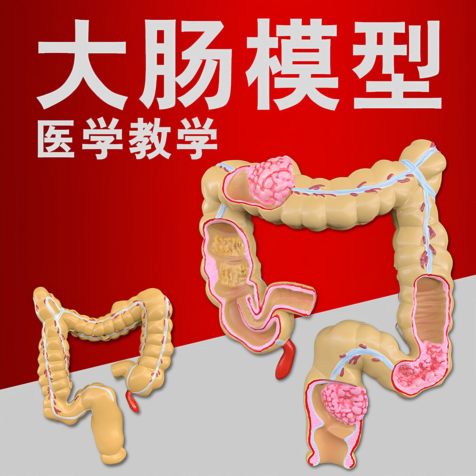 人体大肠结肠病变模型肛肠科消化科肠道解剖医学教学演示仿真教具