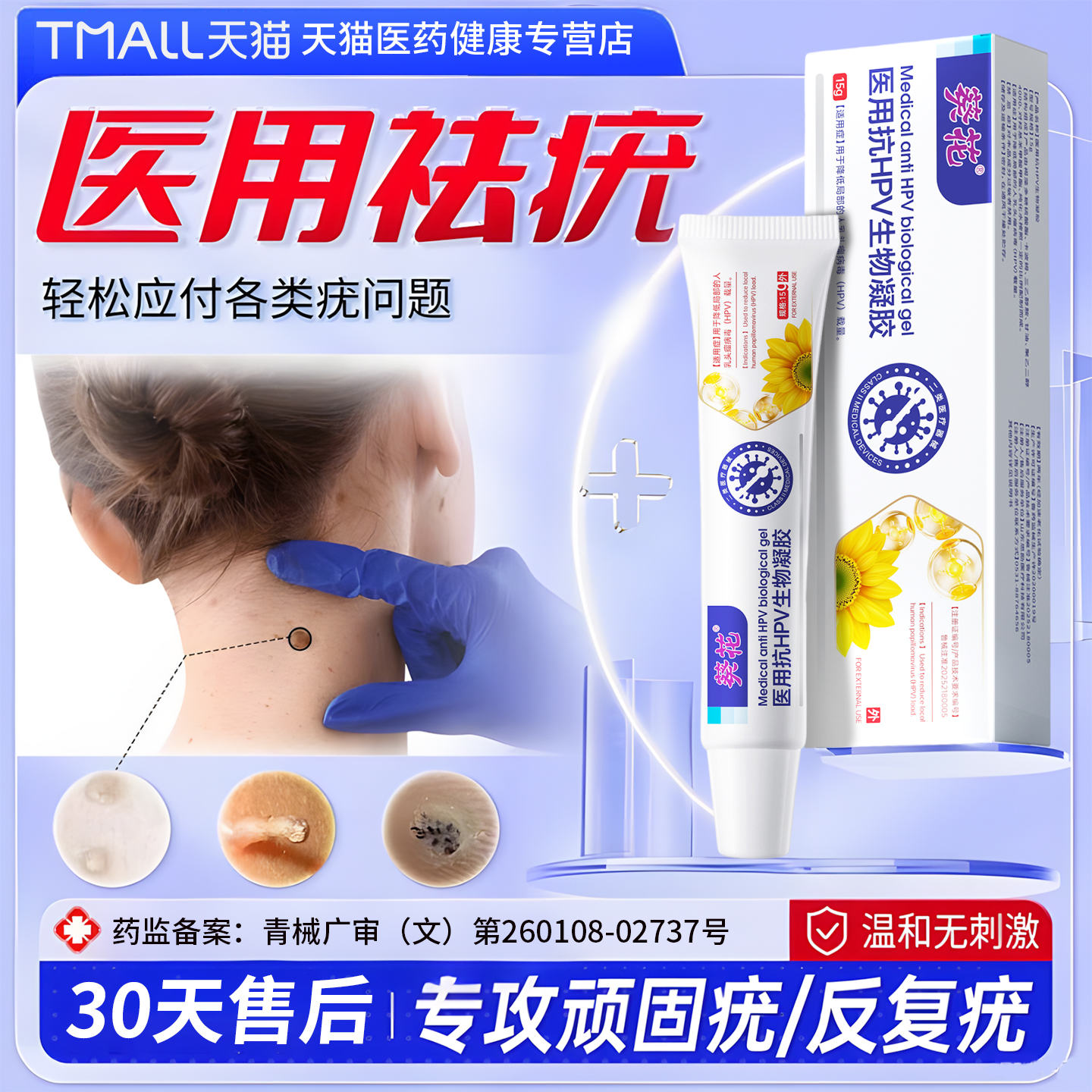 80w人已脱落丨葵花去疣凝胶