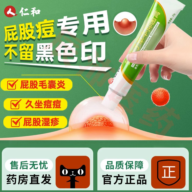 屁股上长疙瘩起热痘痘瘙痒久坐坐板疮坐疮止痒膏湿疹火疖子毛囊炎