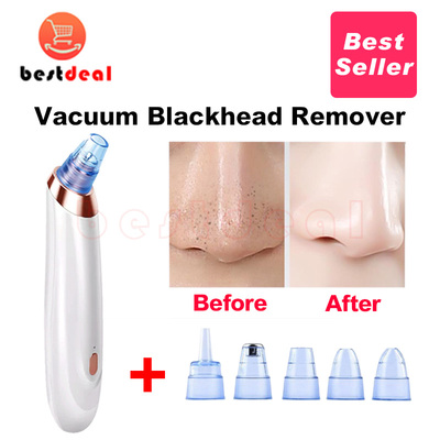 VacuumBlkheadRoverAc