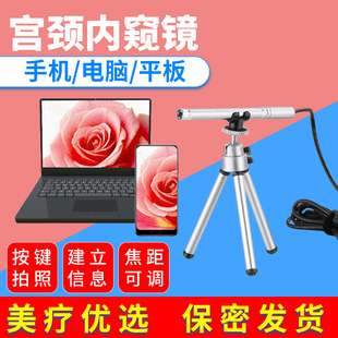 超眼高清电子阴道内窥镜女用私密检查测仪器宫颈肛门镜妇科自检镜