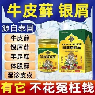 官方旗艦店2hc 泰國斷癢除癬王草本癢膏皮膚百想膏止癢除蘚王正品