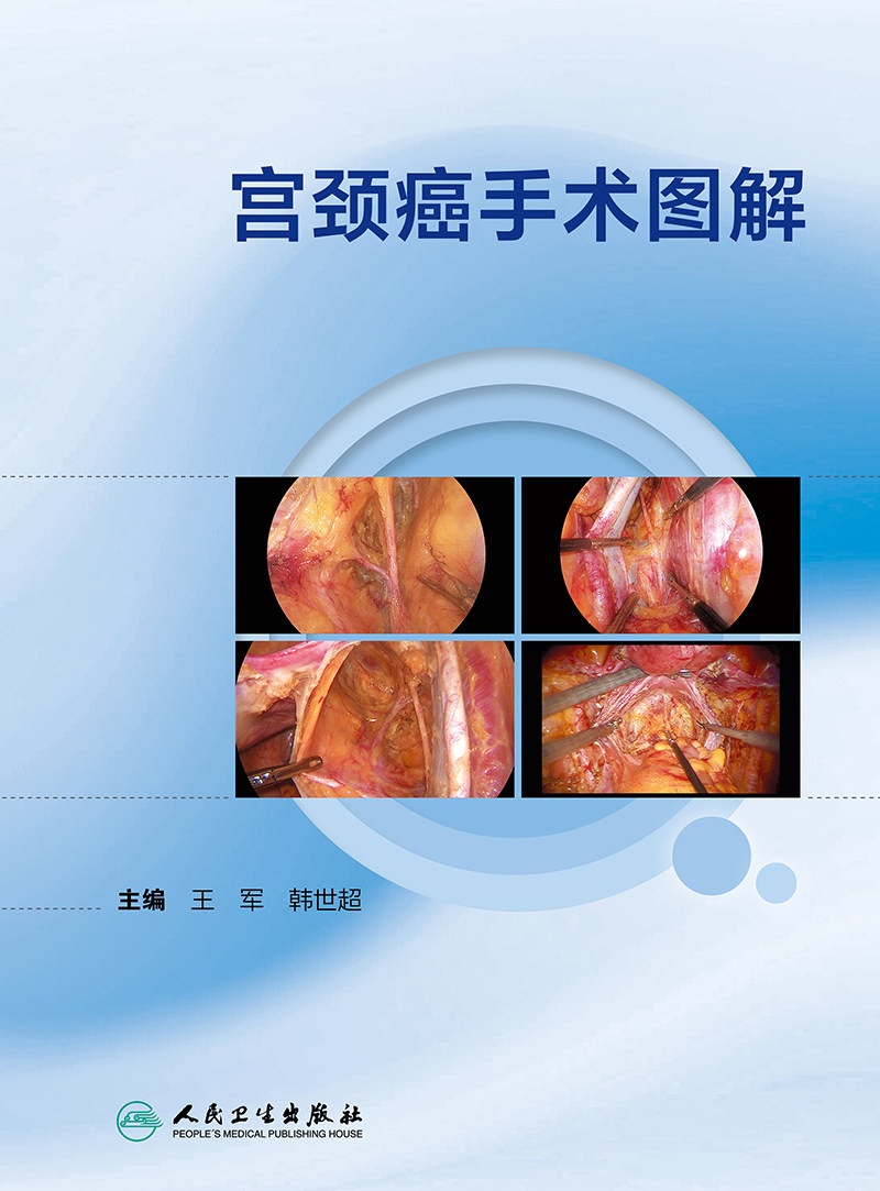 宫颈癌手术图解(配增值)