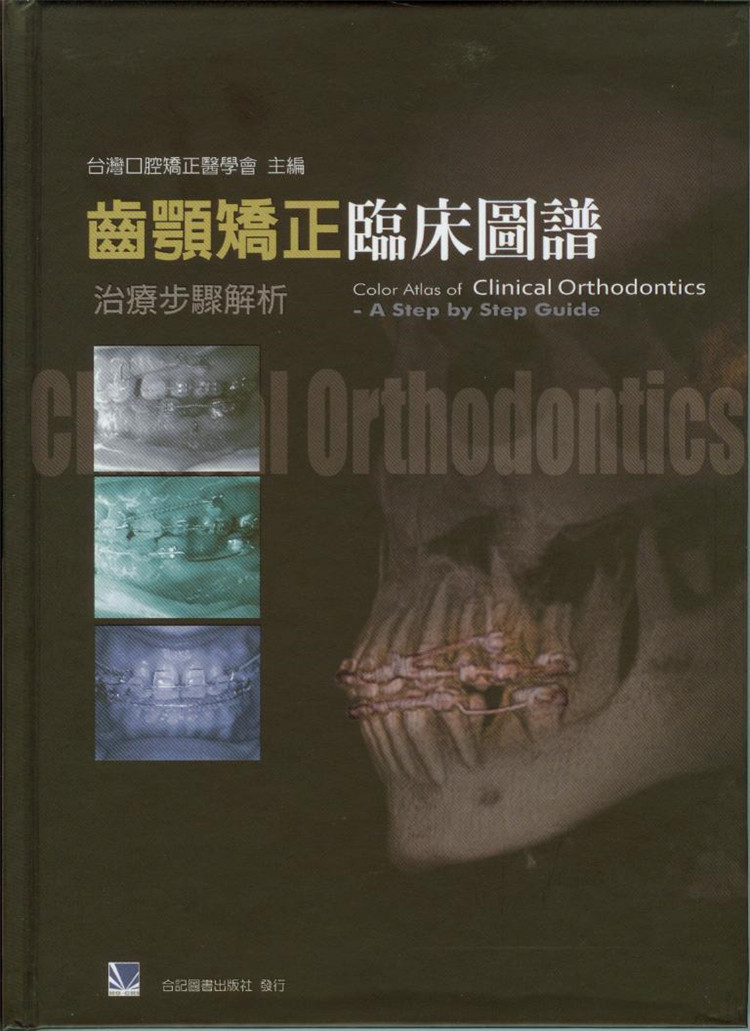 预售 正版 齿颚矫正临床图谱:治疗步骤解析 07 合记 口腔矫正医学 进口原版 审美矫正之临床探讨 侧方错咬的临床探讨 成人骨骼性