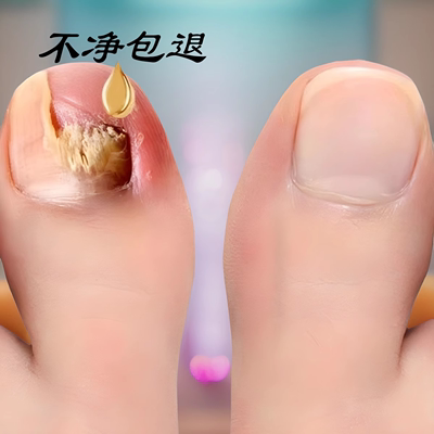 ⭐同仁堂热卖【7天无痛换新钾】⭐滴一滴 坏甲变好jia 抑菌不脱甲