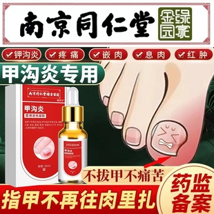 甲沟炎用软甲专消肿去肉芽矫正器治疗灰指甲液脚趾头息肉去除药膏