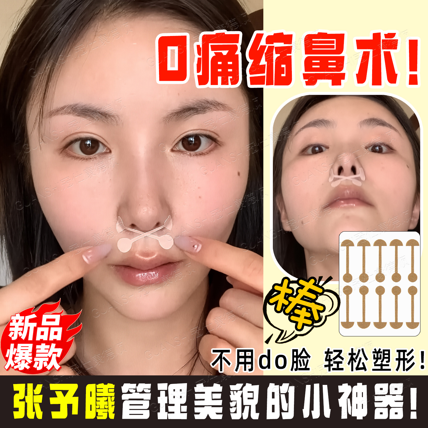 鼻贴鼻甲缩小鼻翼肥大窄鼻小哑铃