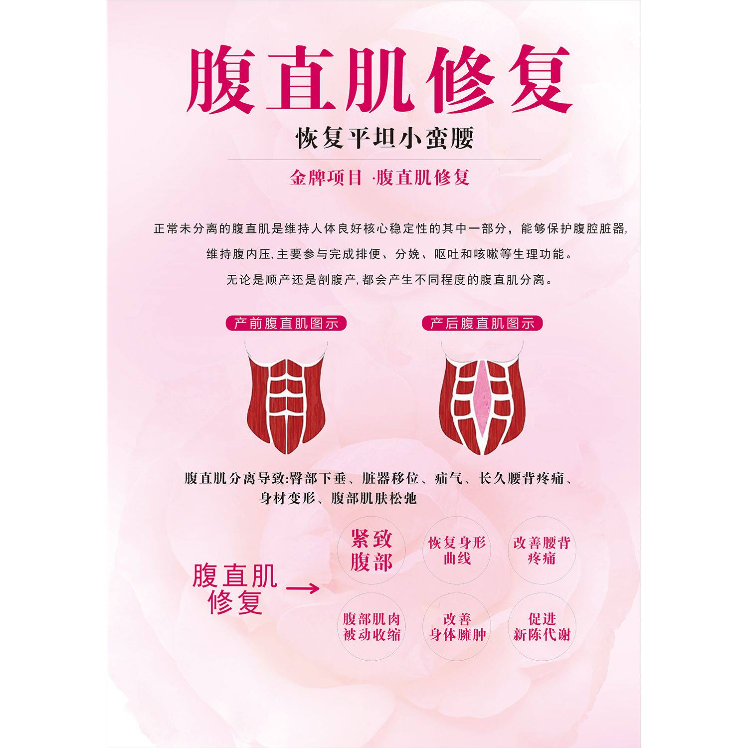 腹直肌修复海报贴画美容院养生馆装饰画理疗贴画广告纸