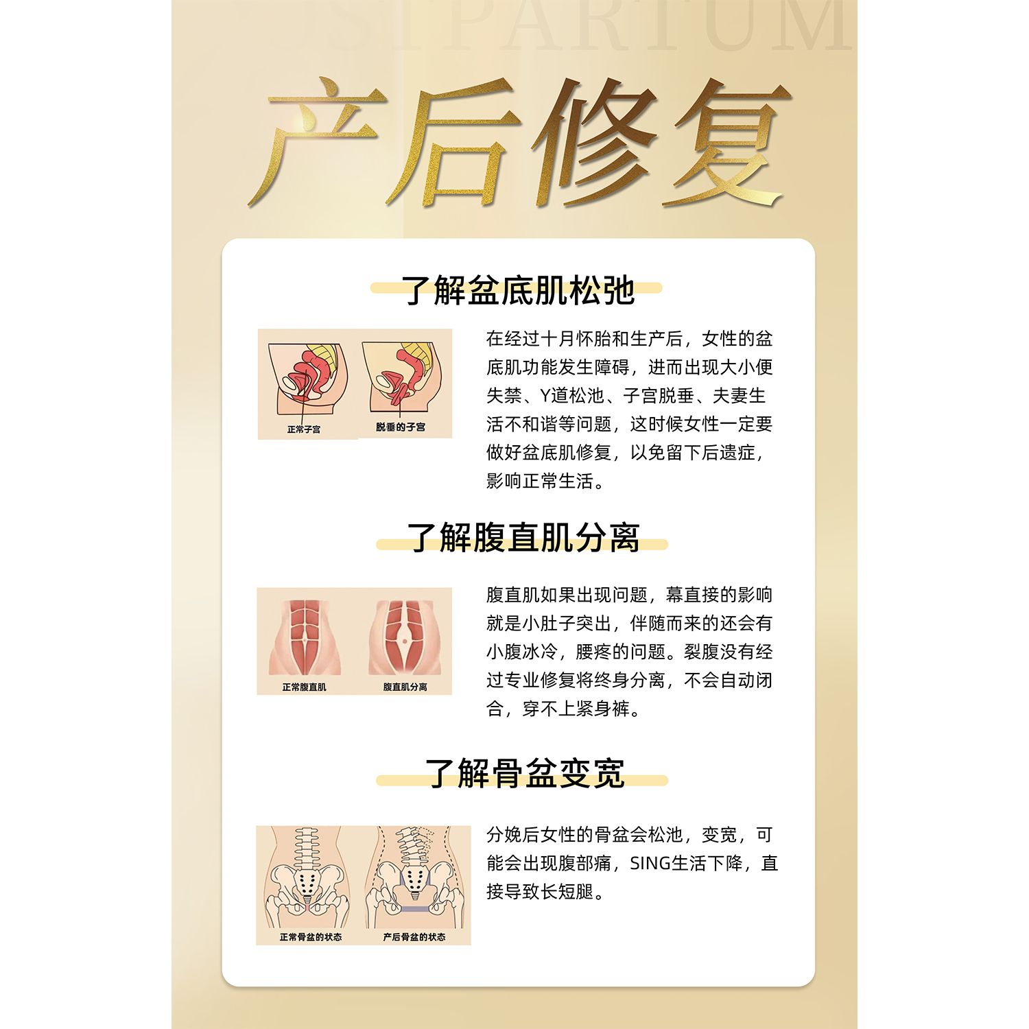 产后修复海报展板关注女性盘底功能修复墙贴纸KT板装饰