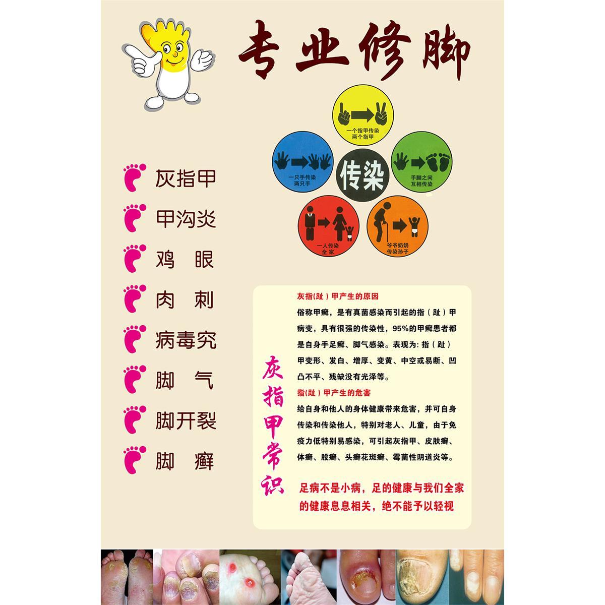 专业修脚新款养生海报灰指甲海报足疗店广告宣传墙贴装饰海报