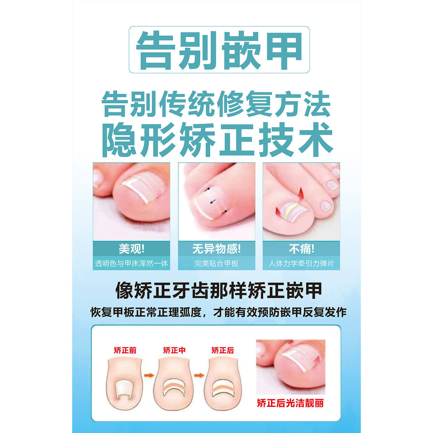 嵌甲贴片广告贴纸海报灰指甲店背景墙手脚常见病图谱灰指甲甲沟炎