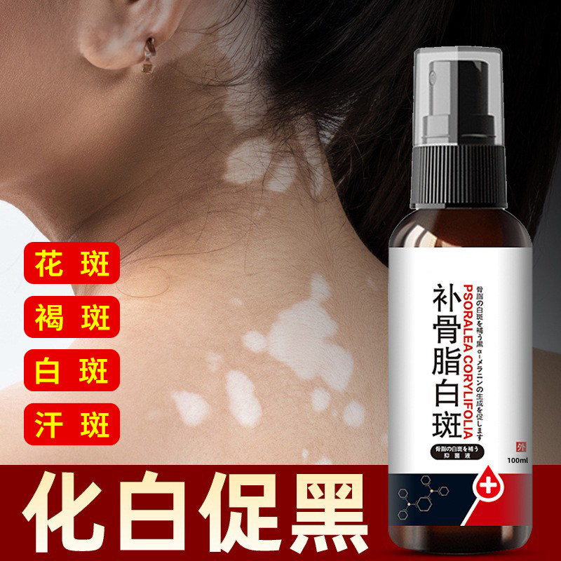 汗斑净复色白斑花斑汗斑褐斑去汉斑花斑藓褐色斑胸前后背腋下白斑