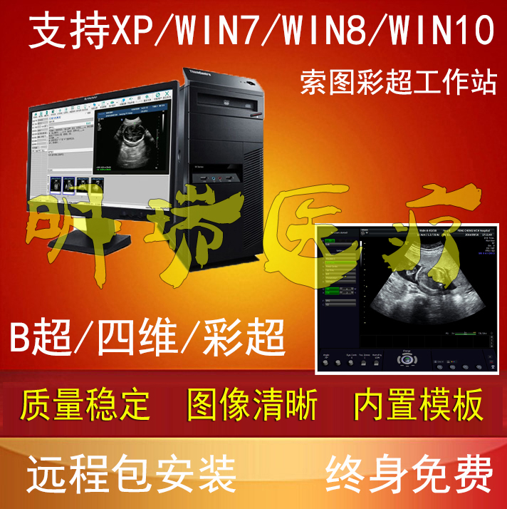 超声工作站软件黑白B超四维彩超软件+采集卡+连接线脚踏全套包邮