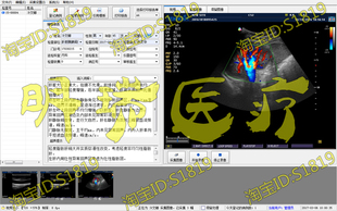淳仁超声软件胃肠镜宫腔镜腹腔镜耳鼻喉镜支气管镜关节镜膀胱镜