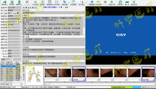 内镜软件耳鼻喉镜软件支气管镜软件非超声随心所欲软件