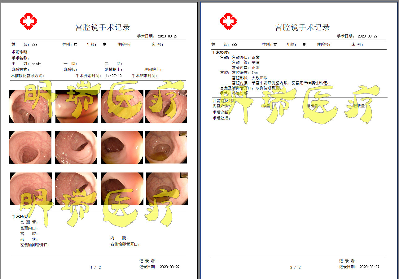宫腔镜腹腔镜软件宫腹腔镜膀胱镜手术室内镜软件内窥镜高清软件
