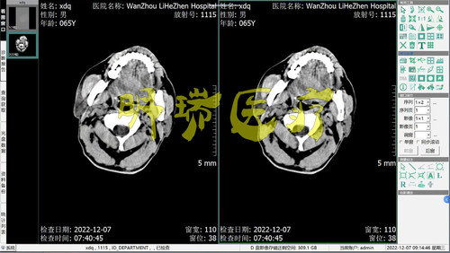 CT工作站软件CT报告软件DR工作站软件CR工作站软件MRI核磁软件