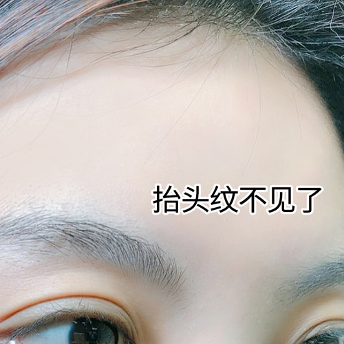 【小红书推荐 告别抬头纹】淡化额头纹 川字纹 男女通用 拍一发二