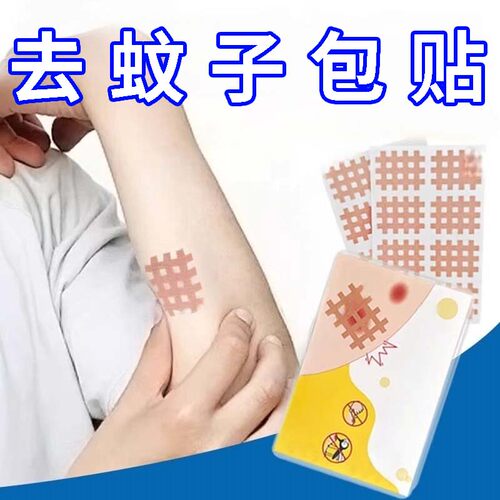 蚊虫叮咬止痒贴便携式舒缓消肿儿童婴幼儿宝宝孕妇通用去蚊子包贴