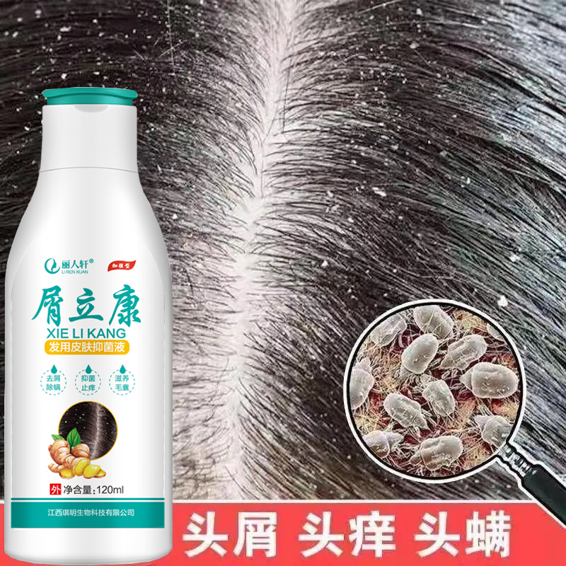头皮毛囊炎膏专用头部痒洗发水中药头上长痘痘药膏止痒溢脂性去屑