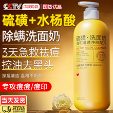 硫磺洗面奶男女士水杨酸洁面乳祛痘深层清洁收缩毛孔控油淡化痘印