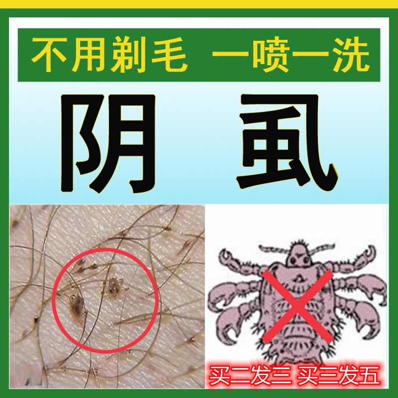 百部酊药复方喷雾喷剂灵不叮布町阴虱男士用私处白百步酊汀虱立净