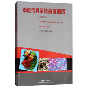 正版现货 心脏传导系统病理图谱(普及版) 心脏传导系统解剖学统检查法