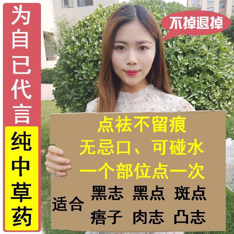 点痣去痣药水无痕正品祛痣膏脸部去斑祛斑痦子取痣除痣黑点雀斑水