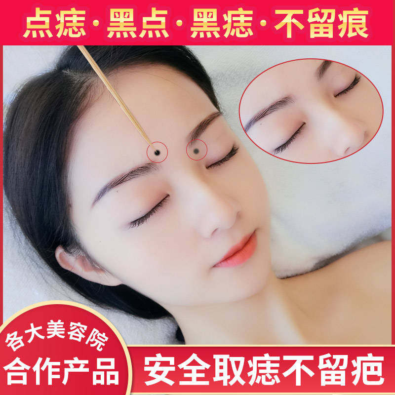 正品去痣点痣药水点痣膏无痕除痣灵去黑痣祛斑点斑水去雀斑祛痣膏