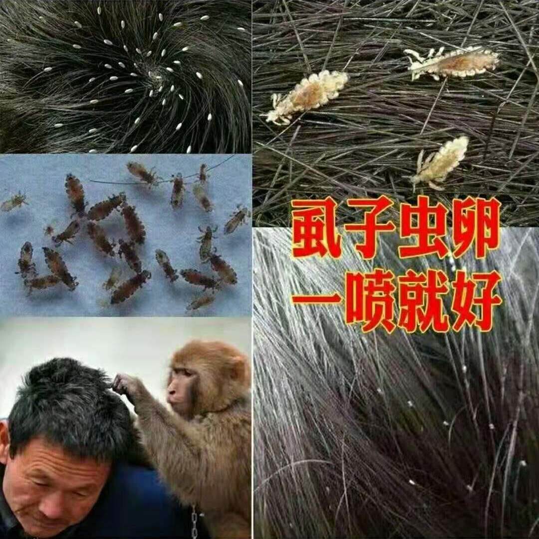 极速去蝨子药儿童成人祛头蝨小女孩头上蝨卵男女通用阴.蝨百部酊