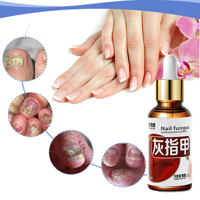 极速Nail Fungal Treatment Feeyt Care Essence Against Fungal