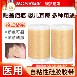 医用自粘性硅胶胶带硅酮凝胶遮盖疤痕贴婴儿耳廓耳朵贴肤色隐形YL