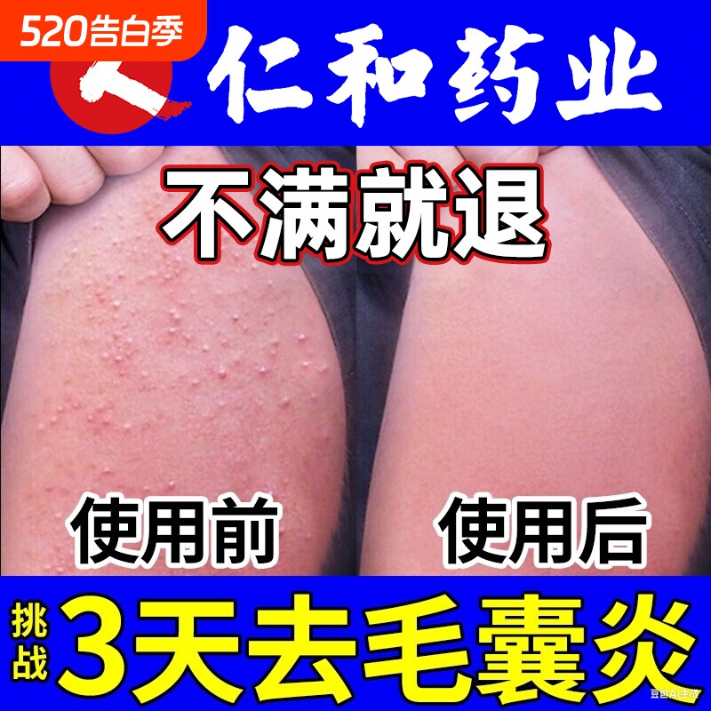 手臂毛囊炎专用长痘痘胳膊上的小疙瘩膏贴净鸡皮肤角化感染