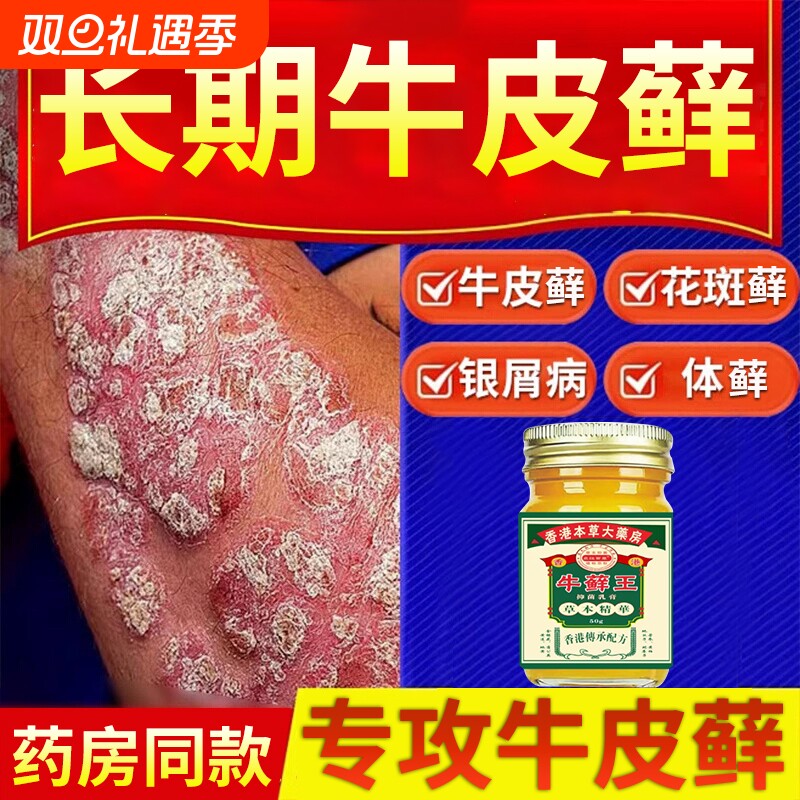 香港牛藓王牛皮痒癣头皮股银去屑病专用膏正品皮肤杀菌止痒抑菌