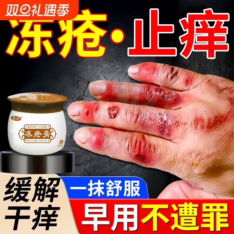冻疮膏缓解干痒｜10000+人加购