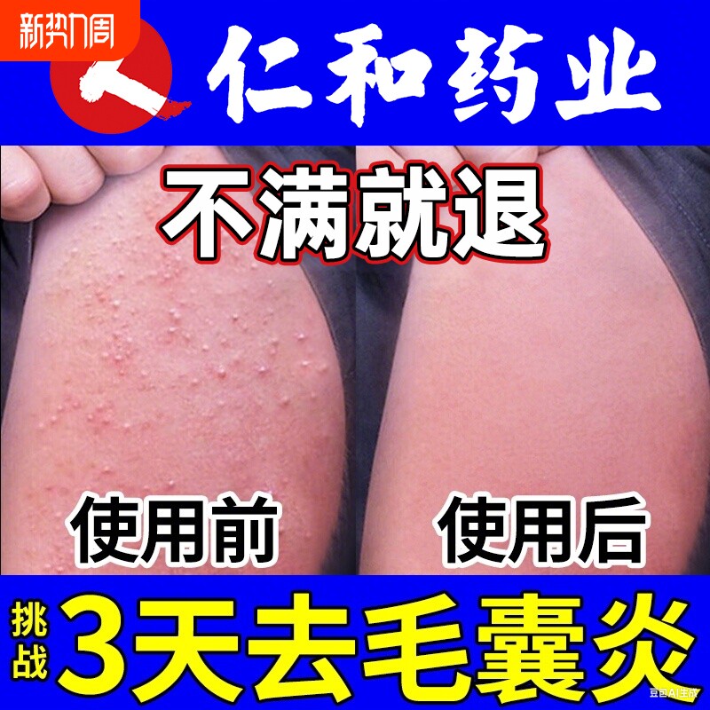 手臂毛囊炎专用长痘痘胳膊上的小疙瘩膏贴净鸡皮肤角化感染