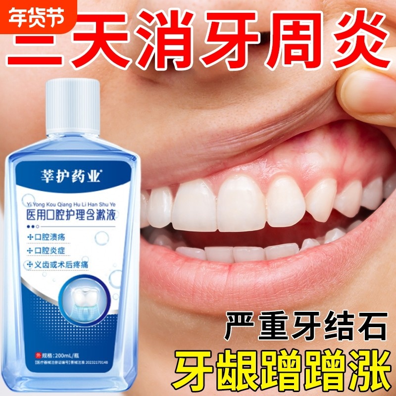 医用漱口水杀菌消炎牙周炎牙龈肿痛除口臭口腔溃疡出血牙结石健康,医疗器械,牙齿防龋/脱敏类,淘宝优惠券,粉丝福利购,淘宝优惠卷