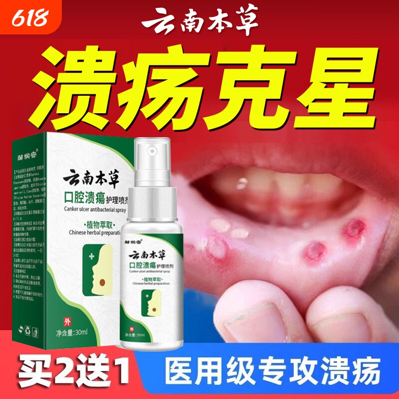 云南本草口腔溃疡喷剂口腔抑菌清新喷剂专用口疮牙龈肿胀痛含漱液