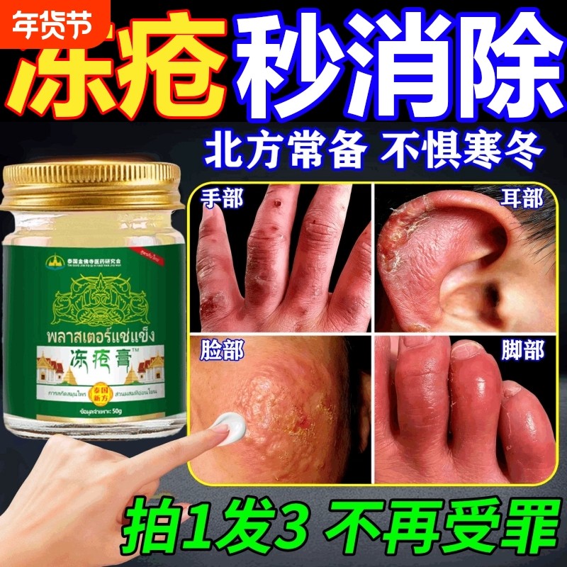 本草冻疮膏手足脚足耳朵干裂止痒修复膏护防冻皲裂医用冻伤膏消肿,保健用品,皮肤消毒护理（消）,淘宝优惠券,粉丝福利购,淘宝优惠卷