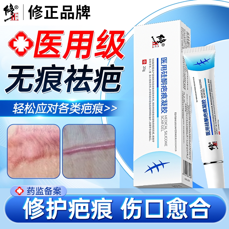 修正祛疤膏去疤痕贴修复除脸部手术疤儿童烫伤剖腹产专用医用凝胶
