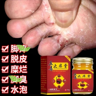 去脚臭克星脚痒脱皮真菌感染烂脚丫专用五毒止痒膏官方旗舰店正品